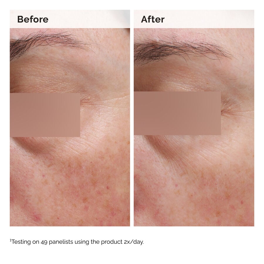 niacinamide-5-face-and-body-emulsion-r0 2024-08-23-ORD-Nia-5pct-Face-Body-B-A-Elasticity-Global-02-1x1.jpg