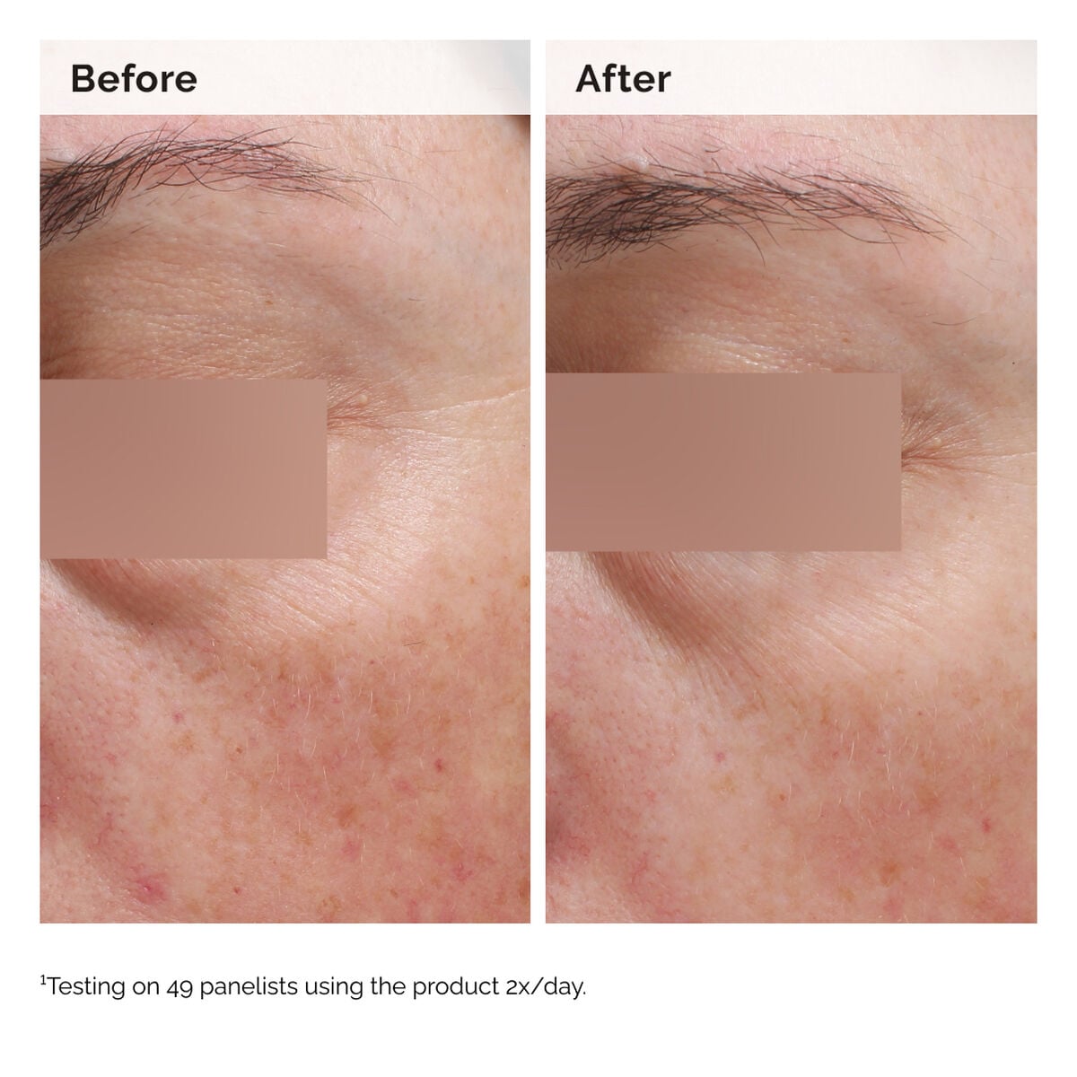 niacinamide-5-face-and-body-emulsion-r0 2024-08-23-ORD-Nia-5pct-Face-Body-B-A-Elasticity-Global-02-1x1.jpg