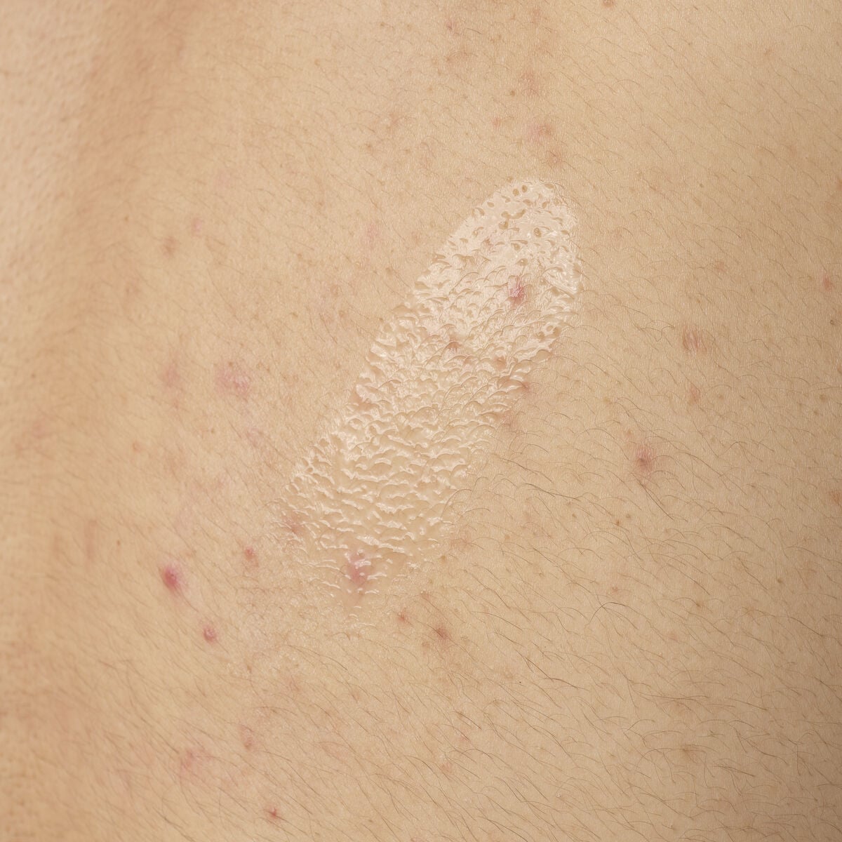 salicylic-acid-0-5-body-serum-z8 ORD-salicylic-acid-05-body-240ml-application.jpg