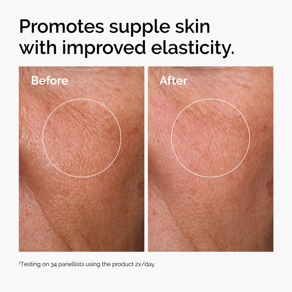 hyaluronic-acid-2-b5-with-ceramides-c8 ord-hyaluronic-acid-2pct-b5-hydrating-serum-before-after-elasticity.jpg