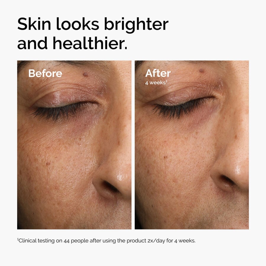 multi-antioxidant-radiance-serum-m7 ord-mars-before-after-healthy.jpg