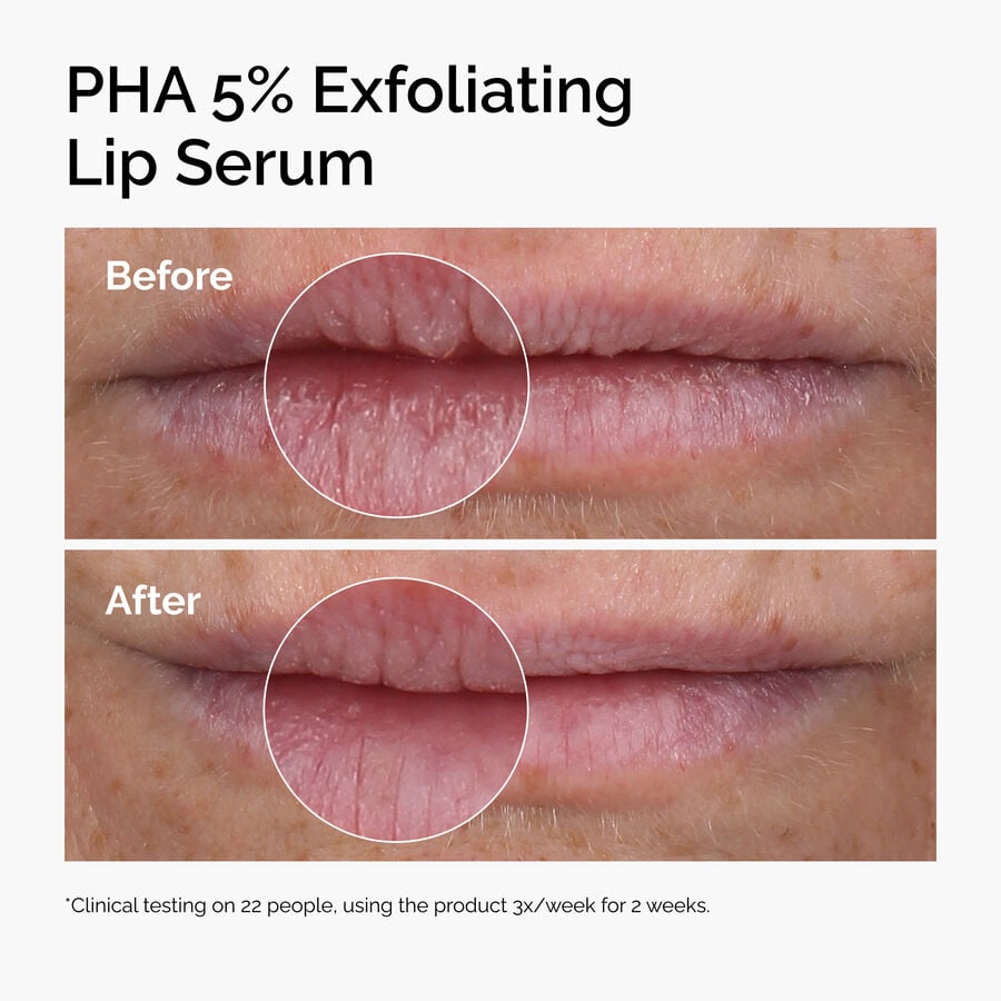 pha-5-exfoliating-lip-serum-t4 ord-pha-5pct-lip-exfoliating-serum-before-after.jpg