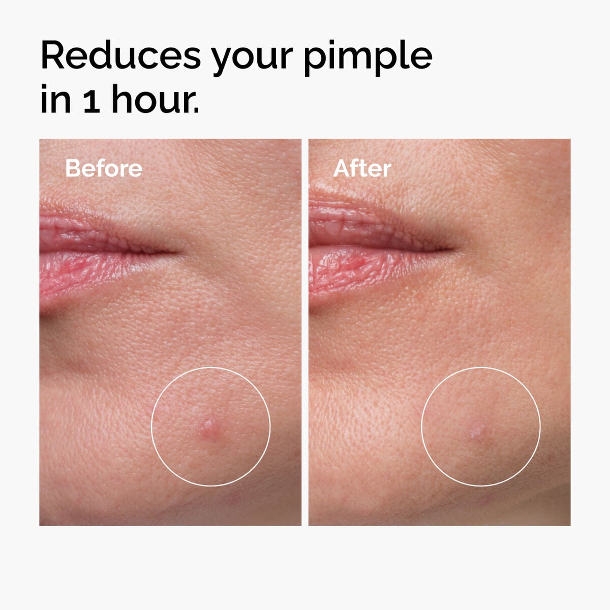 sulfur-10-powder-to-cream-concentrate-n6 ord-sulfur-10pct-powder-to-cream-concentrate-before-after-NA.jpg