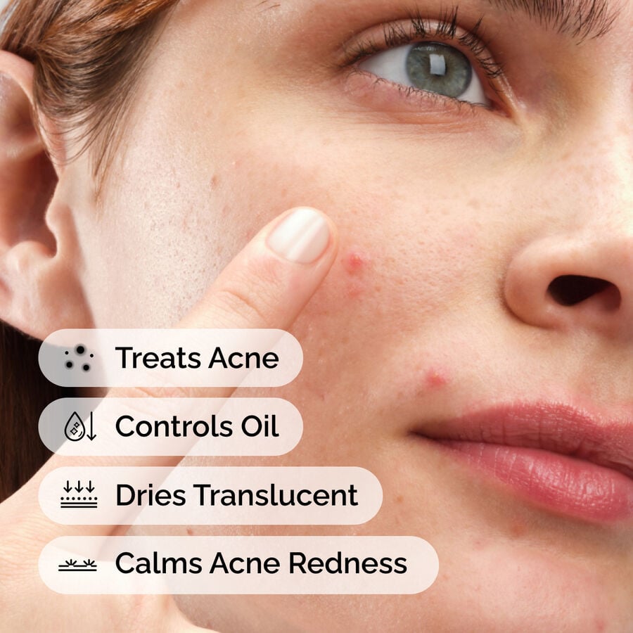 sulfur-10-powder-to-cream-concentrate-n6 ord-sulfur-10pct-powder-to-cream-concentrate-model-application-with-benefits-acne.jpg